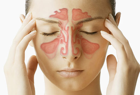 What Is The Best Remedy For Sinus Drainage?
