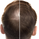 Ancient Chinese Herbal Root Draws Fresh Scientific Interest for Hair Loss